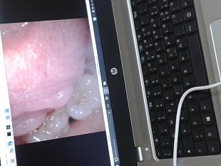 il-s-antonio-abate-nella-rete-di-telemedicina-odontostomatologica-per-pazienti-oncologici-del-policlinico-di-palermo