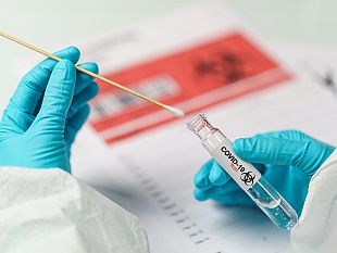 mazara-covid-19-bollettino-asp-tp-del-1-marzo-2022