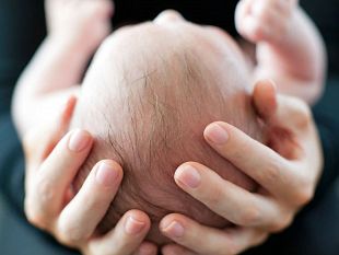 benessere-analizziamo-insieme-allosteopata-giuseppe-denaro-le-plagiocefalie-posizionali-sul-neonato