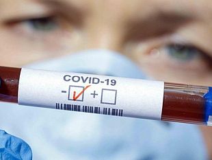 covid-torna-a-salire-il-numero-dei-positivi-a-trapani