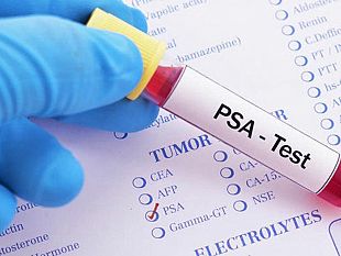 asp-trapani-prima-in-sicilia-per-lesecuzione-dei-test-per-carcinoma-prostatico