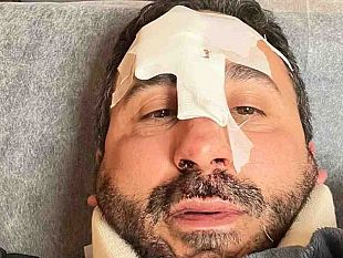 salemi/incidente-in-monopattino-per-lo-chef-natale-giunta