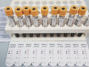 castellammare-coronavirus-il-sindaco-nicolo-rizzo-al-momento-risulta-un-castellammarese-positivo-al-tampone