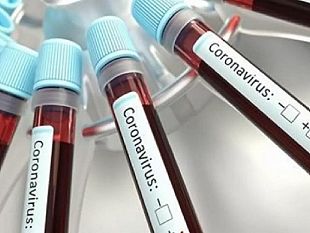 medici-di-famiglia-e-pediatri-potranno-fare-tamponi-rapidi