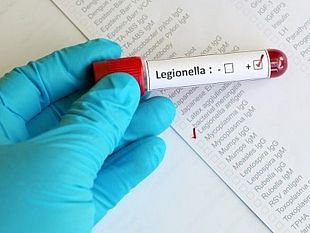 riscontrata-la-legionella-in-una-struttura-per-anziani