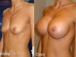 rifarsi-il-seno-ne-parliamo-con-il-dott-gaspare-reina-specialista-in-chirurgia-plastica-e-ricostruttiva