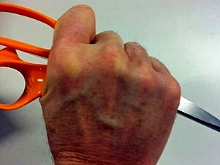 ferito-con-forbici-ai-genitali-dalla-compagna-che-sospetta-un-tradimento