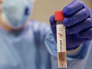 coronavirus-leggera-risalita-in-sicilia-con-28-nuovi-casi-in-provincia-di-trapani-scendono-a-56-i-positivi