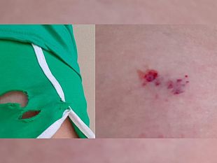 mazara-signora-aggredita-da-un-cane-sul-lungomare-fatamorgana-randagismo-in-citta-che-fare