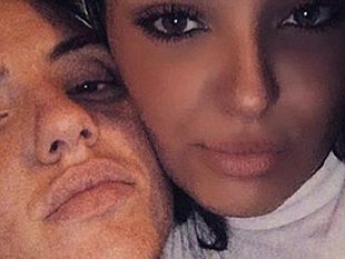 lelzeviro-di-bonagiuso-quando-un-fratello-ammazza-la-sorella-accade-in-italia-nel-2020