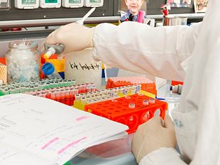 identificato-un-nuovo-potenziale-target-terapeutico-nella-sla