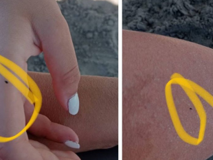 cittadini-lamentano-la-presenza-di-pulci-e-altri-insetti-sulle-spiagge-mazaresi