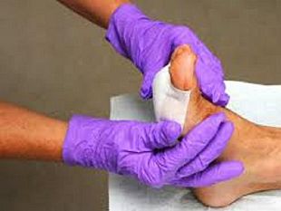 lavvocato-rizzo-risponde-responsabilita-e-risarcimento-danni-da-piaghe-da-decubito