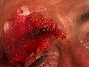 lite-a-marettimo-parla-fazio-aggredito-per-aver-difeso-un-bambino