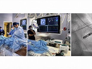pacemaker-leadless-a-mazara-del-vallo-nuova-procedura-per-un-giovane-con-blocco-atrio-ventricolare