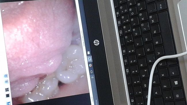 Il S. Antonio Abate nella rete di telemedicina odontostomatologica per pazienti oncologici del Policlinico di Palermo