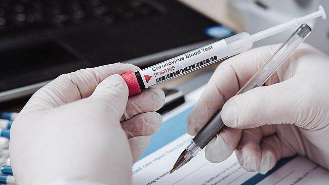 Coronavirus, in Sicilia al via i test sierologici. Ecco chi ne ha diritto e con quali procedure