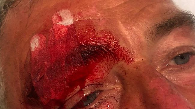 Lite a Marettimo. Parla Fazio: “Aggredito per aver difeso un bambino”