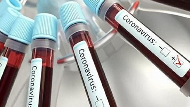 Coronavirus, 286 positivi nel trapanese ed una vittima in più
