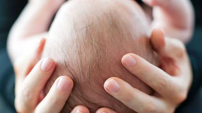 Benessere, analizziamo insieme all'osteopata Giuseppe Denaro le plagiocefalie posizionali sul neonato