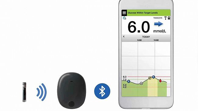 Marsala, impiantato sensore sottocutaneo “Eversense”: svolta per paziente diabetico