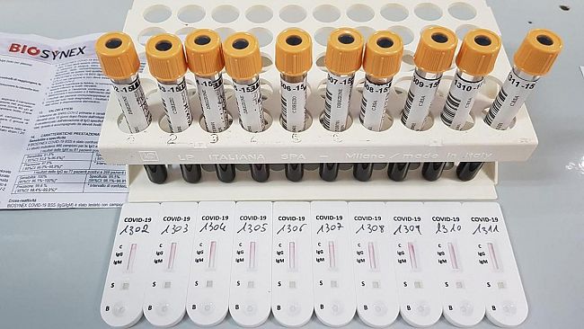 Castellammare, Coronavirus, il sindaco Nicolò Rizzo: “Al momento risulta un castellammarese positivo al tampone