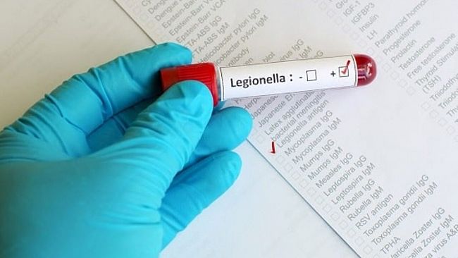 Riscontrata la legionella in una struttura per anziani