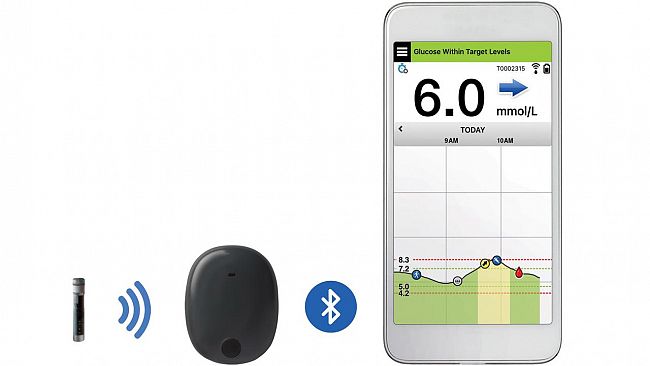 Impiantato a Marsala il nuovo sensore sottocutaneo “Eversense”: Una svolta per il paziente diabetico