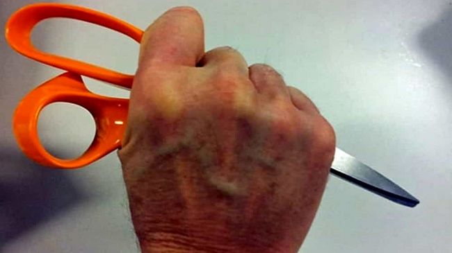 ​Ferito con forbici ai genitali dalla compagna che sospetta un tradimento