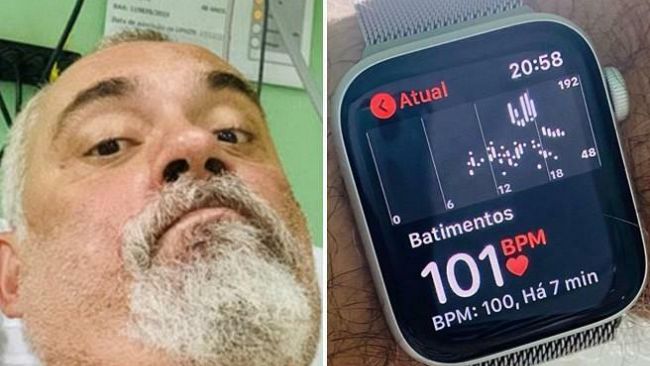 Apple Watch salva la vita ad un uomo