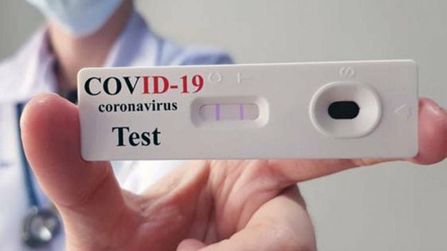 Coronavirus, la Regione siciliana avvia screening con test sierologici per contrastare il contagio