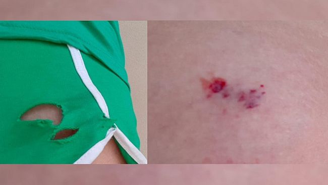 Mazara, signora aggredita da un cane sul lungomare Fatamorgana. Randagismo in Città: che fare?