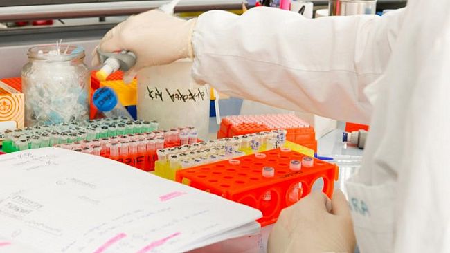 Identificato un nuovo potenziale target terapeutico nella Sla