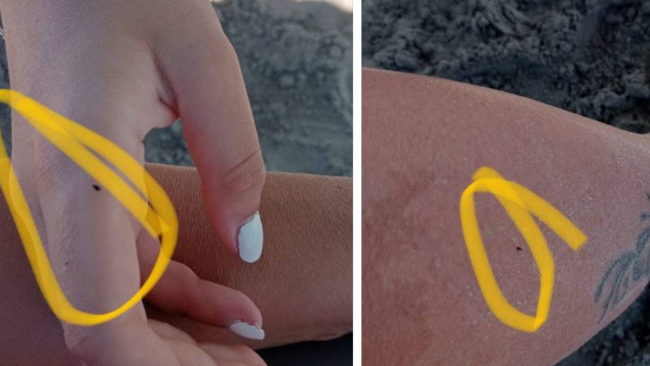 Cittadini lamentano la presenza di pulci e altri insetti sulle spiagge mazaresi