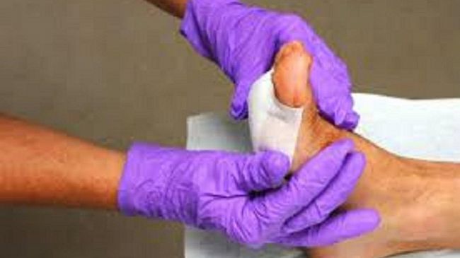 L’Avvocato Rizzo risponde: Responsabilita’ e risarcimento danni da piaghe da decubito