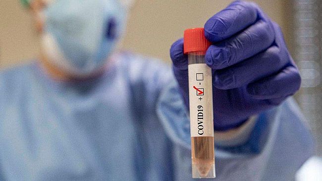 Coronavirus, ben 11 guariti in 24 ore nel trapanese. 67 persone attualmente positive